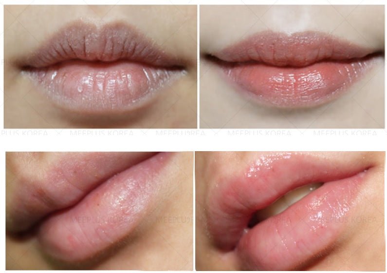 Dr. Drawing BB Lip Solution Kit - Fox|Pharma