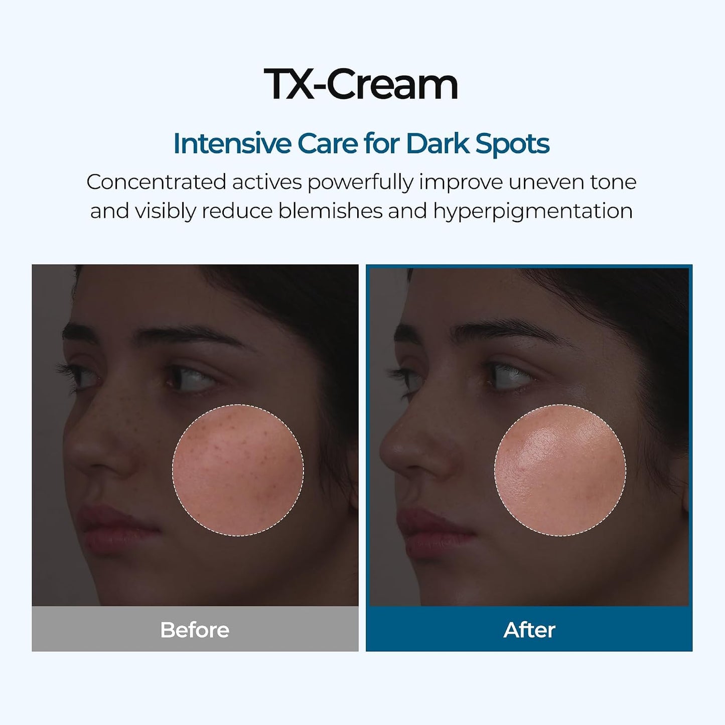Dr.Melaxin TX Cream 1.69 fl. oz. 50 ml
