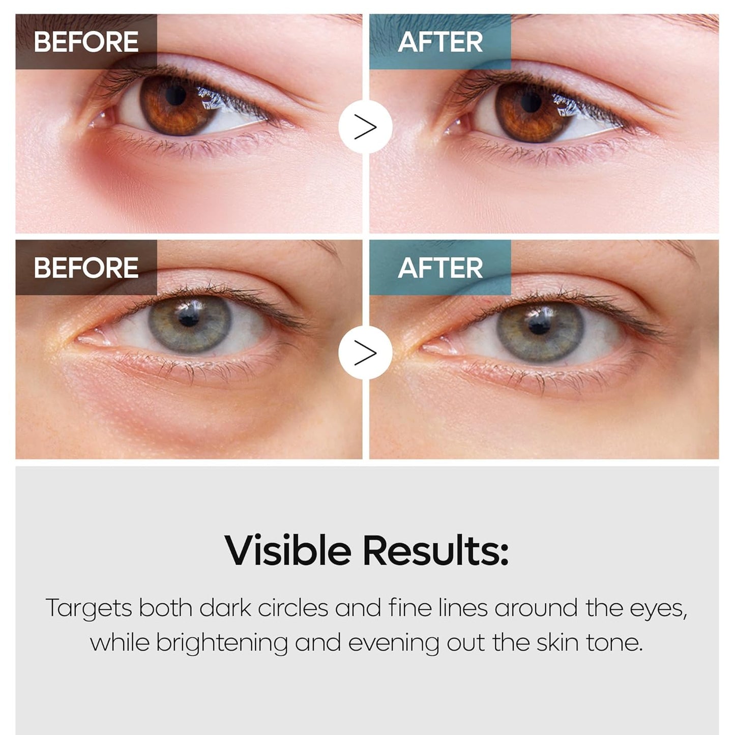 Dr.Melaxin TX Retinalsome Double Effect Eye Cream 1.41 oz. 40 g