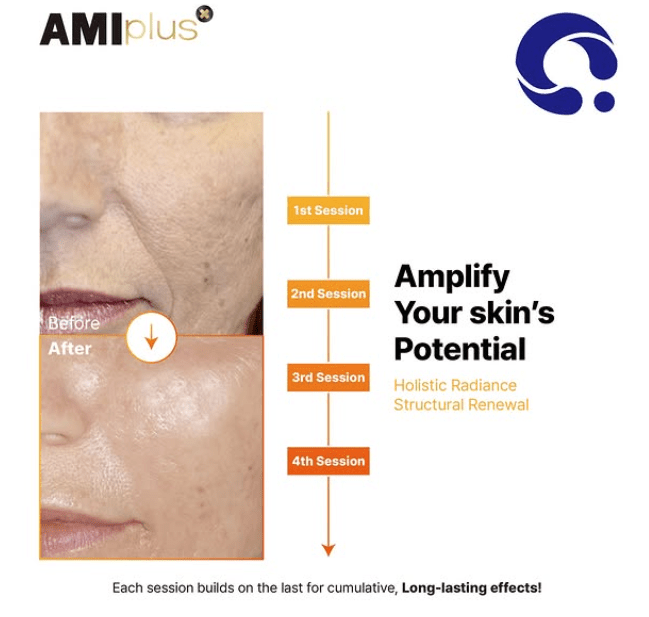 AMI Plus 2% PN 1X2ML - Fox|Pharma