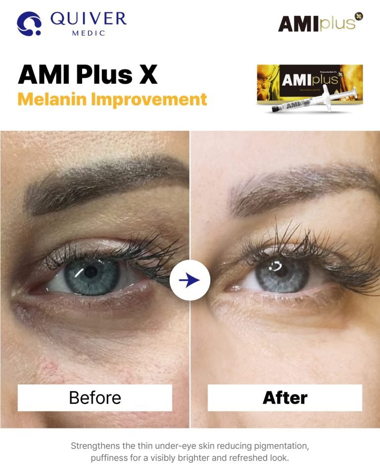 AMI Plus 2% PN 1X2ML - Fox|Pharma