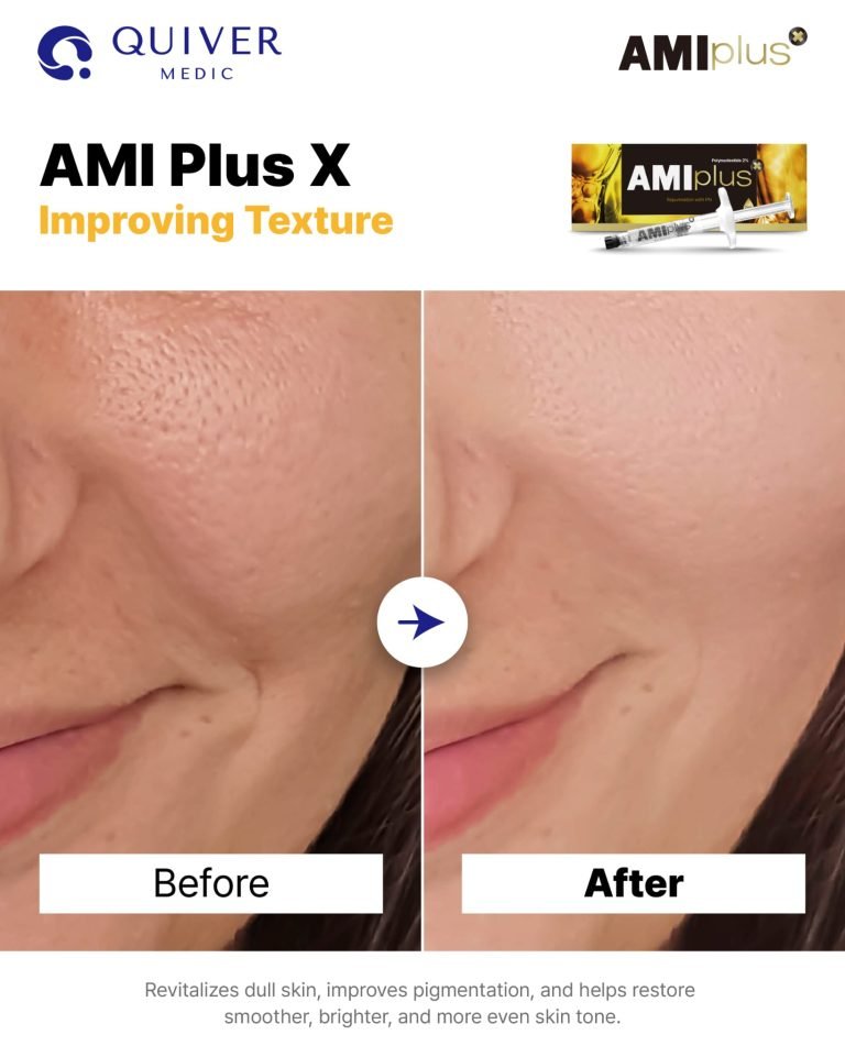 AMI Plus 2% PN 1X2ML - Fox|Pharma