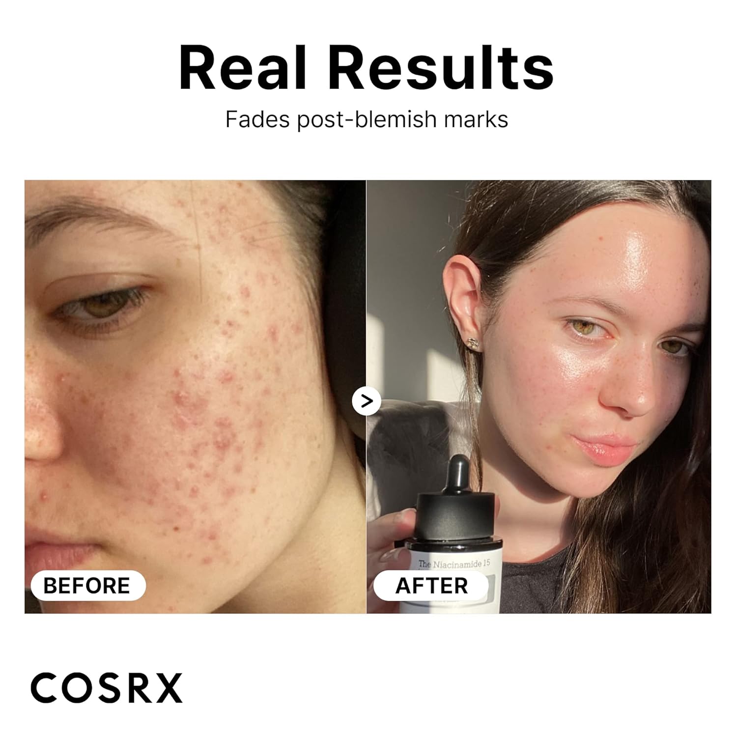 COSRX The Niacinamide 15 Serum 20ml/0.67 fl.oz - Fox|Pharma