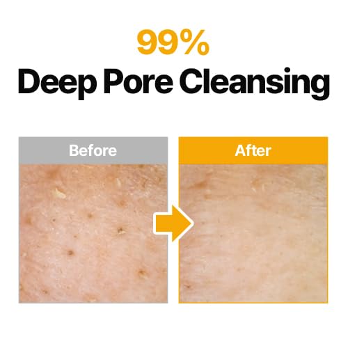 MANYO Pure Cleansing Oil 6.76 fl oz - Fox|Pharma