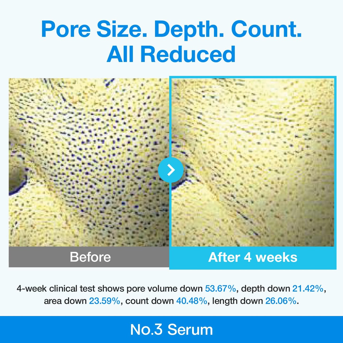 numbuzin No.3 Retinol Serum – Blue Bio - Retinol Pore Refining Serum 1.01 fl.0z. - Fox|Pharma